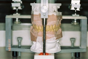 fully adjustable articulator